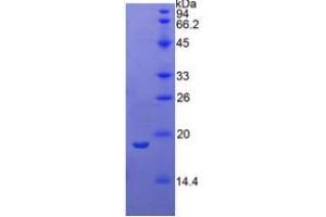 SDS-PAGE analysis of Human Phospholipase A1 Protein. (PLA1A Protein)