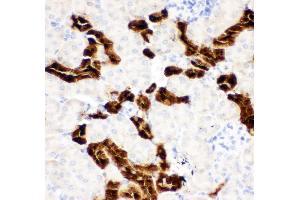 Anti-Calbindin Picoband antibody,  IHC(P): Mouse Kidney Tissue (CALB1 Antikörper  (AA 2-175))