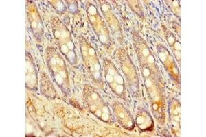 Immunohistochemistry of paraffin-embedded human small intestine tissue using ABIN7174635 at dilution of 1:100