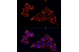 Immunofluorescence analysis of HeLa cells using MTOR antibody. (MTOR Antikörper  (AA 2400-2500))