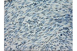 Immunohistochemical staining of paraffin-embedded endometrium tissue using anti-SLC2A5mouse monoclonal antibody. (SLC2A5 Antikörper)
