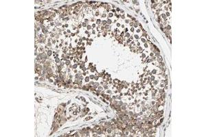 Immunohistochemical staining of human testis with ZNF37A polyclonal antibody  shows cytoplasmic positivity in cells of seminiferus ducts at 1:20-1:50 dilution. (ZNF37A Antikörper)