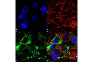 Immunocytochemistry/Immunofluorescence analysis using Mouse Anti-Nav1. (Nav1.8 Antikörper  (AA 1724-1956))