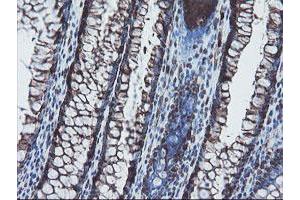 Image no. 2 for anti-SKI-Like Oncogene (SKIL) (AA 307-684) antibody (ABIN1491380) (SKIL Antikörper  (AA 307-684))