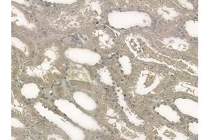 ABIN6256137 and ABIN6267203 at 1/100 staining human normal kidney tissue by IHC-P. (Tuberin Antikörper  (pSer1387))