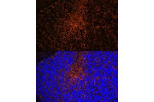 Immunofluorescence analysis of mouse brain using Aquaporin-4 (Aquaporin-4 ) Rabbit mAb (ABIN7265653) at dilution of 1:100 (40x lens). (Aquaporin 4 Antikörper)