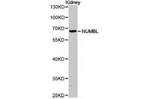 Western Blotting (WB) image for anti-Numb Homolog (Drosophila)-Like (NUMBL) antibody (ABIN1873987) (NUMBL Antikörper)