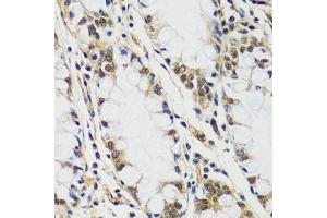 Immunohistochemistry of paraffin-embedded human colon using C antibody (ABIN6127552, ABIN6137952, ABIN6137953 and ABIN6216977) at dilution of 1:100 (40x lens). (CASC5 Antikörper  (AA 1-300))
