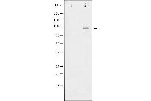 Western blot analysis of Catenin-β expression in 293 whole cell lysates,The lane on the left is treated with the antigen-specific peptide. (CTNNB1 Antikörper  (N-Term))