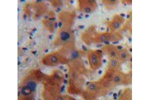 Used in DAB staining on fromalin fixed paraffin-embedded Liver tissue (Caspase 7 Antikörper  (AA 24-198))