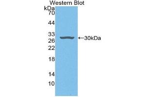 Western Blotting (WB) image for anti-Hepatoma-Derived Growth Factor (HDGF) (AA 10-240) antibody (ABIN1868349)