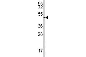 Western Blotting (WB) image for anti-E2F Transcription Factor 1 (E2F1) (AA 310-344) antibody (ABIN3030785)