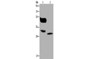 Gel: 10 % SDS-PAGE, Lysate: 40 μg, Lane 1-2: A375 cells, human lung cancer tissue, Primary antibody: ABIN7130137(MAGEA8 Antibody) at dilution 1/400, Secondary antibody: Goat anti rabbit IgG at 1/8000 dilution, Exposure time: 30 seconds (MAGEA8 Antikörper)