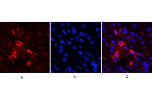 Immunofluorescence analysis of human stomach cancer tissue.