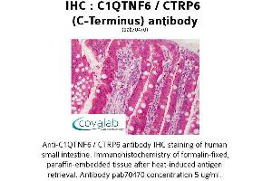 Image no. 1 for anti-Complement C1q Tumor Necrosis Factor-Related Protein 6 (C1QTNF6) antibody (ABIN1732486) (CTRP6 Antikörper)