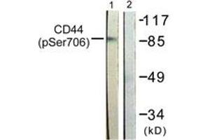 Western blot analysis of extracts from NIH-3T3 cells treated with PMA 250ng/ml 5', using CD44 (Phospho-Ser706) Antibody. (CD44 Antikörper  (pSer706))