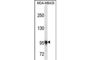 PLOD3 Antibody (N-term) (ABIN656661 and ABIN2845902) western blot analysis in MDA-M cell line lysates (35 μg/lane). (PLOD3 Antikörper  (N-Term))