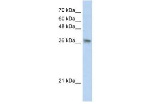 PHYHIP antibody used at 1 ug/ml to detect target protein. (PHYHIP Antikörper  (N-Term))