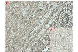 Immunohistochemical staining of human tissue using anti-DLK1 (human), mAb (PF13-3)  at 1:500 dilution. (DLK1 Antikörper  (Extracellular Domain))