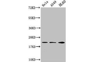 Western Blot Positive WB detected in: Hela whole cell lysate, A549 whole cell lysate, HL60 whole cell lysate All lanes: HIST1H1C antibody at 1:500 Secondary Goat polyclonal to rabbit IgG at 1/40000 dilution Predicted band size: 22 kDa Observed band size: 22 kDa (HIST1H1C Antikörper)