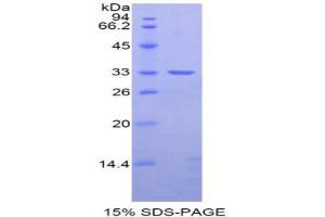 SDS-PAGE analysis of Rat Nexilin Protein.