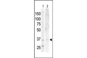 The anti-PKA/C alpha/beta Pab is used in Western blot to detect PKA/C alpha in Jurkat cell lysate (lane 1) and mouse heart tissue lysate (lane 2). (PRKACA Antikörper  (N-Term))