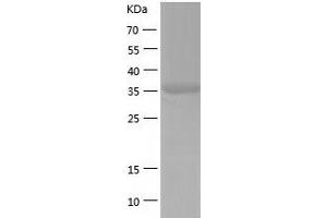 UPB1 Protein (AA 1-384) (His tag)