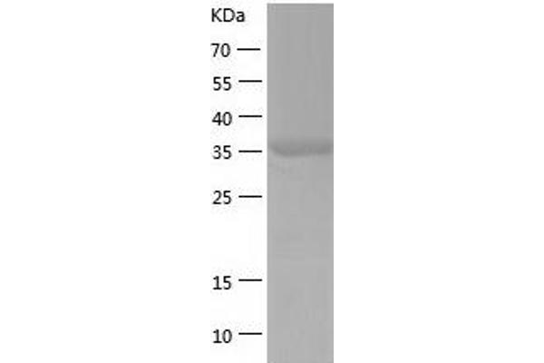 UPB1 Protein (AA 1-384) (His tag)