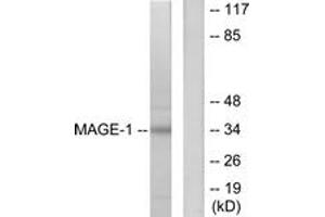 Western blot analysis of extracts from HepG2 cells, using MAGE-1 Antibody. (MAGEA1 Antikörper  (AA 260-309))