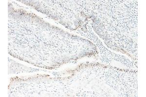 Image no. 1 for anti-Chemokine (C-X-C Motif) Ligand 1 (Melanoma Growth Stimulating Activity, Alpha) (CXCL1) antibody (ABIN464980) (CXCL1 Antikörper)