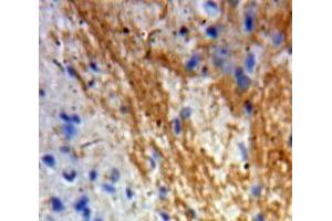 IHC-P analysis of Brain tissue, with DAB staining. (GDNF Antikörper  (AA 78-211))