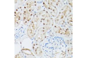 Immunohistochemistry (IHC) image for anti-Adenosine Kinase (ADK) (AA 200-345) antibody (ABIN7265462)