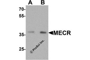 Western Blotting (WB) image for anti-Mitochondrial Trans-2-Enoyl-CoA Reductase (MECR) (C-Term) antibody (ABIN1077414) (MECR Antikörper  (C-Term))