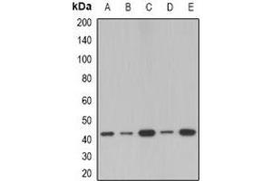 Western Blotting (WB) image for anti-serpin Peptidase Inhibitor, Clade B (Ovalbumin), Member 1 (SERPINB1) antibody (ABIN7306502)