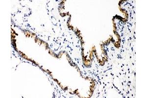IHC-P: GSTP1 antibody testing of rat lung tissue (GSTP1 Antikörper  (AA 2-210))
