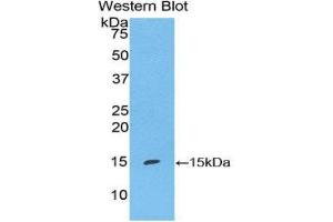 Western Blotting (WB) image for anti-S100 Calcium Binding Protein A7 (S100A7) (AA 1-108) antibody (ABIN1860486) (S100A7 Antikörper  (AA 1-108))