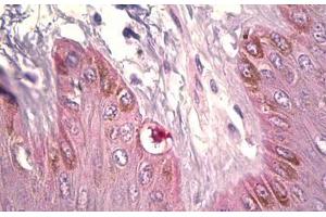 Anti-DCT antibody IHC staining of human skin, melanocytes. (DCT Antikörper  (AA 51-100))
