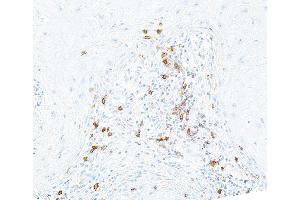 Immunohistochemistry (IHC) image for anti-Inducible T-Cell Co-Stimulator (ICOS) (AA 149-199) antibody (ABIN7453973) (Rekombinanter ICOS Antikörper  (AA 149-199))