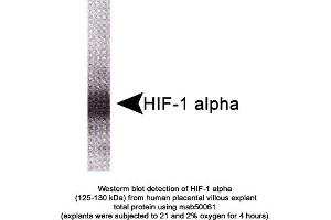 Image no. 1 for anti-Hypoxia Inducible Factor 1, alpha Subunit (Basic Helix-Loop-Helix Transcription Factor) (HIF1A) (AA 329-530) antibody (ABIN363215) (HIF1A Antikörper  (AA 329-530))