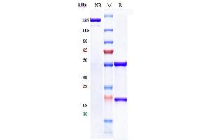 Anti-SLC7A11 Reference Antibody (Agilvax Patent Anti-Slc7A11) on SDS-PAGE under reducing (R) condition.