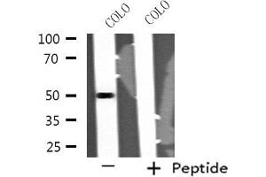 Western blot analysis of extracts from COLO cells, using STK24 antibody. (STK24 Antikörper  (N-Term))