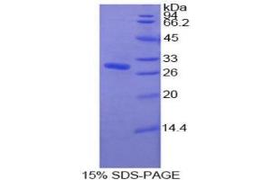 SDS-PAGE analysis of Human Pyridoxal Kinase Protein. (PDXK Protein)