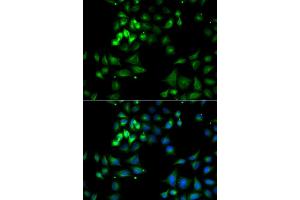 Immunofluorescence analysis of A549 cell using HYOU1 antibody. (HYOU1 Antikörper)