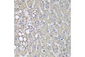 Immunohistochemistry of paraffin-embedded human liver injury using PIK3C2A antibody at dilution of 1:100 (x40 lens). (PIK3C2A Antikörper)