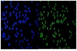 IF analysis of HDAC9 using anti-HDAC9 antibody (ABIN7602333). (HDAC9 Antikörper  (AA 7-469))