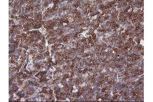 Immunohistochemistry (IHC) image for anti-T-cell surface glycoprotein CD1c (CD1C) antibody (ABIN2670658) (CD1c Antikörper)