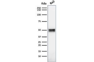 Western Blot Analysis of Raji cell lysate using CD79a Mouse Monoclonal Antibody (HM47/A9). (CD79a Antikörper  (AA 202-216))