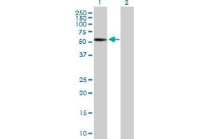 Western Blot analysis of CDYL2 expression in transfected 293T cell line by CDYL2 MaxPab polyclonal antibody. (CDYL2 Antikörper  (AA 1-506))