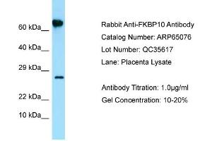 Western Blotting (WB) image for anti-FK506 Binding Protein 10, 65 KDa (FKBP10) (N-Term) antibody (ABIN2790034) (FKBP10 Antikörper  (N-Term))
