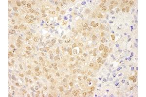 Immunohistochemistry (IHC) image for anti-C-Abl Oncogene 1, Non-Receptor tyrosine Kinase (ABL1) (AA 850-900) antibody (ABIN7448914) (ABL1 Antikörper  (AA 850-900))